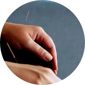 acupuncture treatment springfield IL