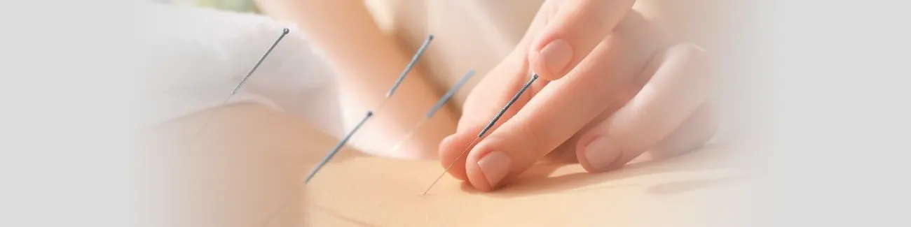 Acupuncture Treatment in Springfield, IL Near Me