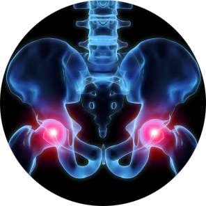 hip pain treatment Springfield IL